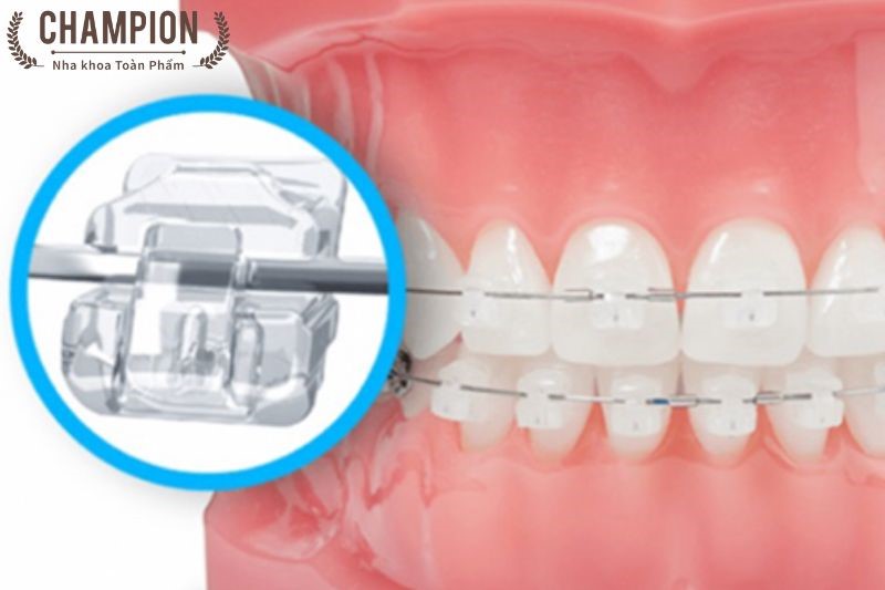 Mắc cài pha lê cổ điển 