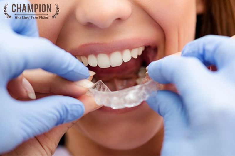 A nighttime dental guard