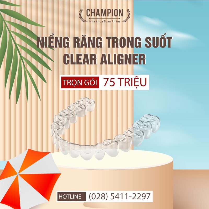 Chỉ từ 75 Triệu - Niềng răng thôi!