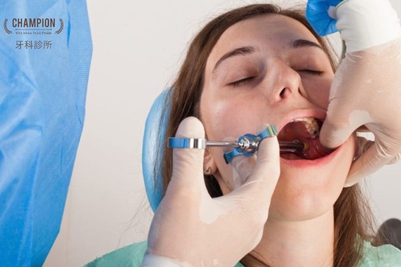 Trồng Răng Implant Đơn Lẻ Trồng Răng Implant Đơn Lẻ